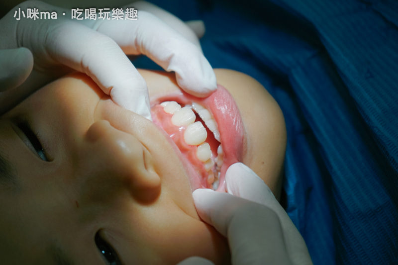 新莊牙科推薦