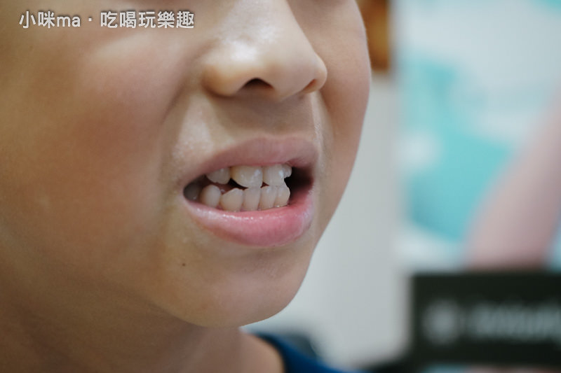 新莊牙科推薦